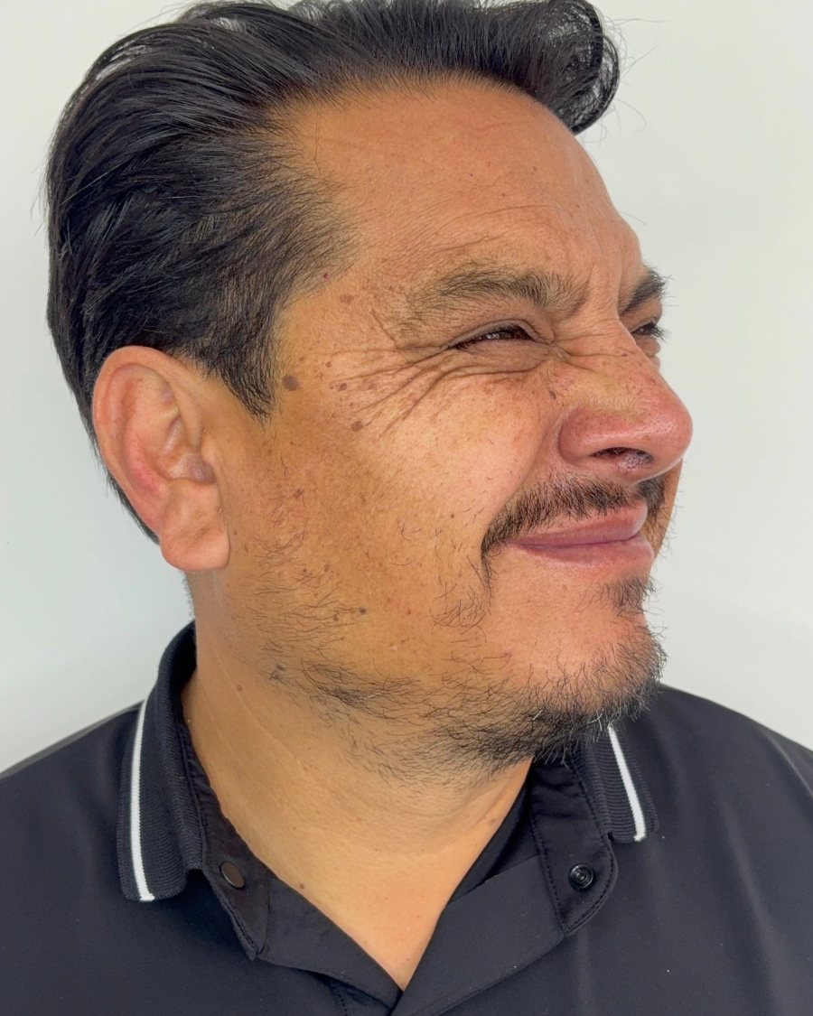 Antes del tratamiento: perfil
