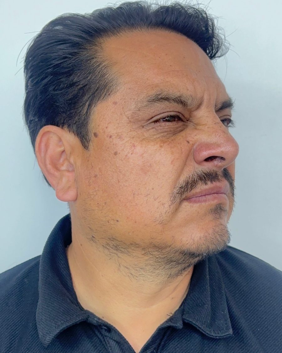 Después del tratamiento: perfil